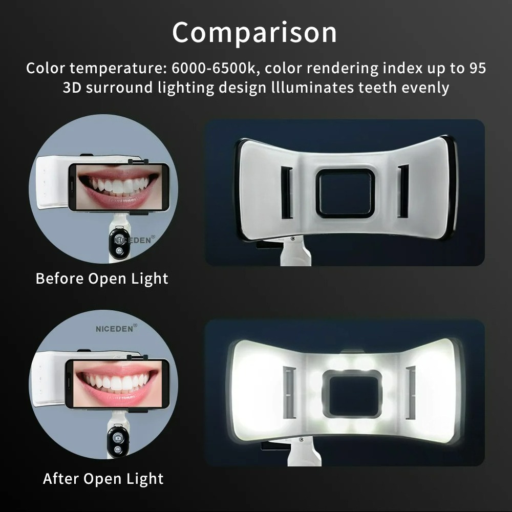 Dental-Fotografie-Licht für Sm – Photography Lighting Accessories Bewertung und Preis