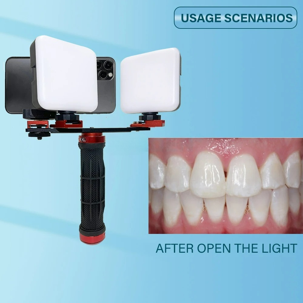 Dental-Fotografie-Licht für Sm – Photography Lighting Accessories Bewertung und Preis